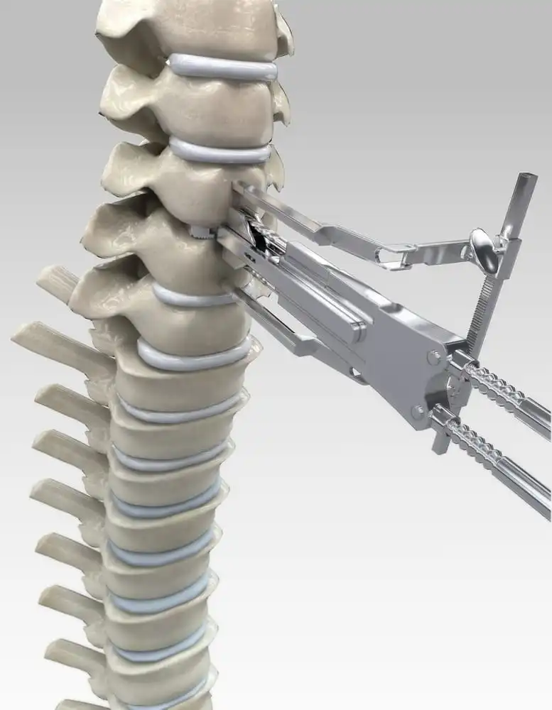 BEST DISC REPALCEMENT - in Kolkata – Dr Binod Kumar Singhania