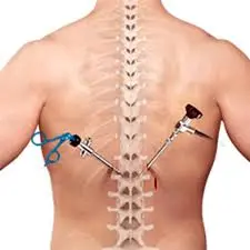 BEST MINIMALLY INVASIVE SPINE SURGERY - in Kolkata – Dr Binod Kumar Singhania